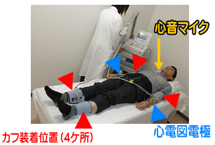 血圧脈波検査