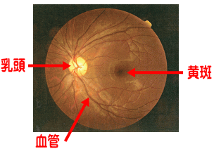 正常眼底写真